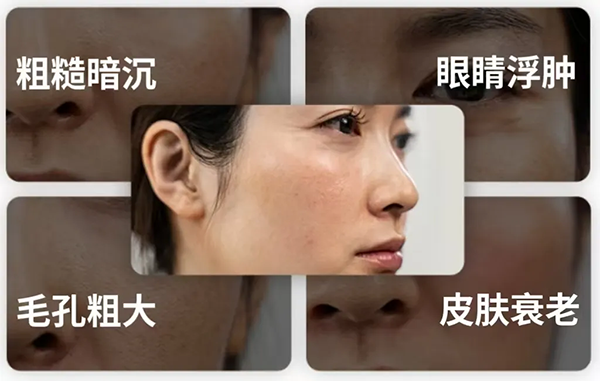 冰磯堂顏究站 | 熬夜后皮膚為何會(huì)變黃？